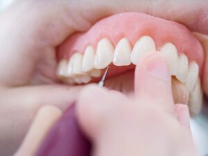 Common Questions About Zirconia Teeth in Brooklyn NY