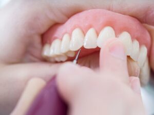 Common Questions About Zirconia Teeth
