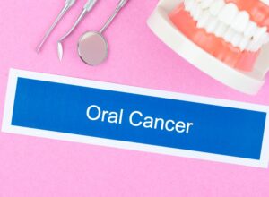 Oral cancer screening Oral cancer screening by Beyond Dentistry Laser Center in Brooklyn, NY
